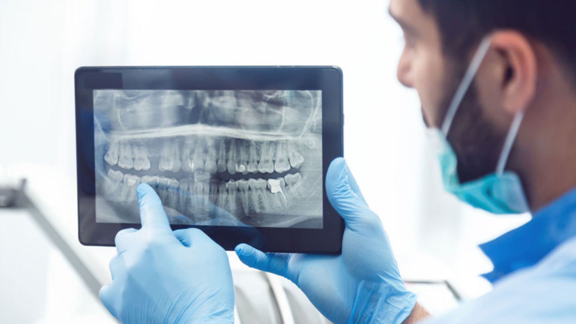Dentist showing x-ray on tablet